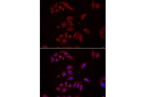 Immunofluorescence analysis of U2OS cells using NPHP1 antibody (ABIN5974022). (NPHP1 antibody)