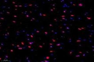 Immunofluorescent analysis of paraformaldehyde-fixed rat heart using,SUN2 (ABIN7075502) at dilution of 1: 1000 (SUN2 antibody)