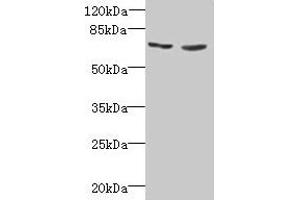 Western blot All lanes: TNFRSF11A antibody at 2 μg/mL Lane 1: EC109 whole cell lysate Lane 2: 293T whole cell lysate Secondary Goat polyclonal to rabbit IgG at 1/15000 dilution Predicted band size: 67, 33, 37, 29, 57, 65 kDa Observed band size: 67 kDa (TNFRSF11A antibody  (AA 28-202))