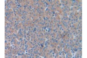 DAB staining on IHC-P; Samples: Mouse Ovary Tissue (LCN5 antibody  (AA 28-187))