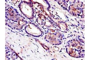 Immunohistochemistry of paraffin-embedded human pancreatic tissue using ABIN7173365 at dilution of 1:100 (TRIB3 antibody  (AA 152-325))