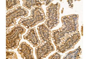 ABIN6260867 and ABIN6266510 at 1/100 staining Rat colon tissue by IHC-P. (Claudin 5 antibody  (C-Term))