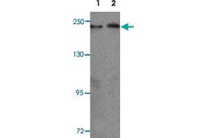 Western blot analysis of KLOTHO in rat heart tissue lysate with KL polyclonal antibody  at 1 ug/mL (lane 1) and 2 ug/mL (lane 2).