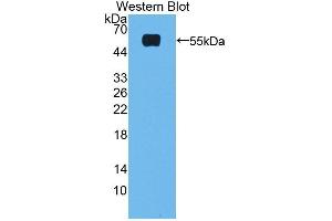 Detection of Recombinant FXR, Rat using Polyclonal Antibody to Farnesoid X Receptor (FXR) (NR1H4 antibody  (AA 375-568))