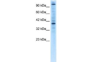 Human Jurkat; WB Suggested Anti-ZNF624 Antibody Titration: 0. (ZNF624 antibody  (Middle Region))