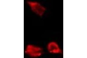 ABIN6278012 staining Hela by IF/ICC. (Calpain S1 antibody  (Internal Region))