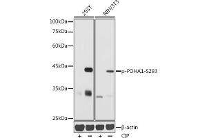 Western blot analysis of extracts of various cell lines, using Phospho-PDH-S293 antibody (ABIN7269769) at 1:1000 dilution. (PDHA1 antibody  (pSer293))