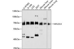 Western blot analysis of extracts of various cell lines, using NPLOC4 antibody (ABIN1681086, ABIN5664262, ABIN5664264 and ABIN6220175) at 1:3000 dilution. (NPLOC4 antibody  (AA 1-270))