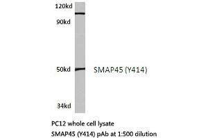 Western blot (WB) analysis of SMAP45 antibody in extracts from PC12 cells. (HDAC3 antibody)