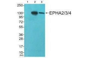 Western blot analysis of extracts from A549 cells (Lane 2) and HepG2 cells (Lane 3), using EPHA2/3/4 (Ab-588/596) antiobdy. (EPH Receptor A2 antibody  (Tyr588, Tyr596))