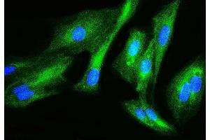 IF analysis of Filamin B/FLNB using anti-Filamin B/FLNB antibody (ABIN7601607). (FLNB antibody  (AA 397-701))