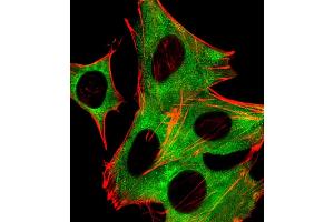 Fluorescent image of SH-SY5Y cells stained with P2R5B Antibody (C-term) (ABIN6243837 and ABIN6577726). (PPP2R5B antibody  (C-Term))