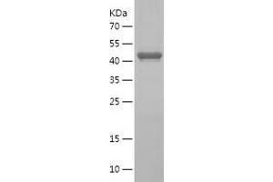 Western Blotting (WB) image for Golgin B1 (GOLGB1) (AA 3007-3192) protein (His-IF2DI Tag) (ABIN7284024) (Golgin B1 (GOLGB1) (AA 3007-3192) protein (His-IF2DI Tag))