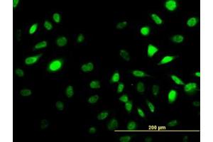 Image no. 1 for anti-Sestrin 2 (SESN2) (AA 1-481) antibody (ABIN466250) (Sestrin 2 antibody  (AA 1-481))