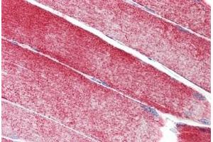 Human Skeletal Muscle: Formalin-Fixed, Paraffin-Embedded (FFPE) (MAP3K10 antibody  (AA 110-138))