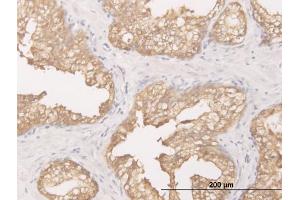 Immunoperoxidase of monoclonal antibody to DCXR on formalin-fixed paraffin-embedded human prostate. (DCXR antibody  (AA 145-244))