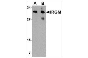 Western blot analysis of IRGM in human brain lysate with this product at (A) 1 and (B) 2 μg/ml. (IRGM antibody  (Center))