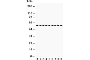 Western blot testing of Vimentin antibody and Lane 1:  HT1080;  2: NIH3T3;  3: Jurkat;  4: HUT;  5: MCF-7;  6: HeLa;  7: human placenta;  8: rat testis;  9: mouse testis lysate (Vimentin antibody  (C-Term))