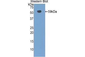 Western blot analysis of the recombinant protein. (SLC3A2 antibody  (AA 282-523))