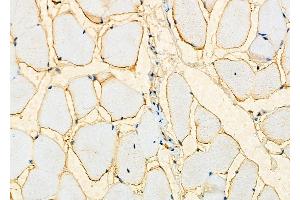 ABIN6259906 and ABIN6276534 at 1/100 staining Mouse muscle tissue by IHC-P.