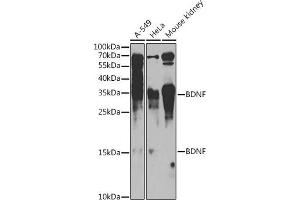 Western blot analysis of extracts of various cell lines, using BDNF antibody (ABIN6129991, ABIN6137522, ABIN6137524 and ABIN6215043) at 1:1000 dilution. (BDNF antibody  (AA 20-247))
