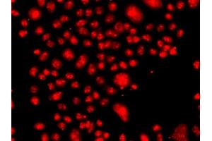 Immunofluorescence analysis of  cells using FANCM antibody (ABIN6127918, ABIN6140478, ABIN6140479 and ABIN6223515). (FANCM antibody  (AA 390-660))