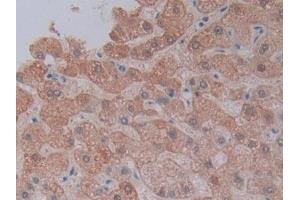 Immunohistochemistry (IHC) image for anti-Cytochrome P450, Family 3, Subfamily A, Polypeptide 4 (CYP3A4) (AA 344-497) antibody (ABIN7435469)