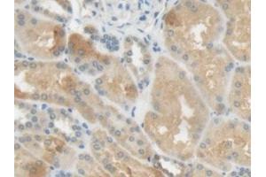 Immunohistochemistry (IHC) image for anti-C-Reactive Protein (CRP) (AA 17-224) antibody (ABIN7442345)