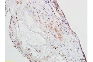Formalin-fixed and paraffin embedded rat aorta tissue labeled with Anti-PPAR Gamma Polyclonal Antibody, Unconjugated (ABIN1386283) at 1:300 followed by conjugation to the secondary antibody (PPARG antibody  (AA 315-420))
