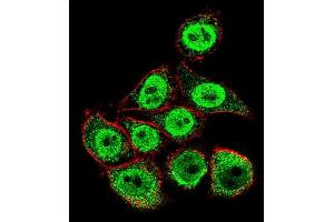 Confocal immunofluorescent analysis of TYSY Antibody (C-term) (ABIN1882144 and ABIN2840937) with Hela cell followed by Alexa Fluor 488-conjugated goat anti-rabbit lgG (green). (TYMS antibody  (C-Term))