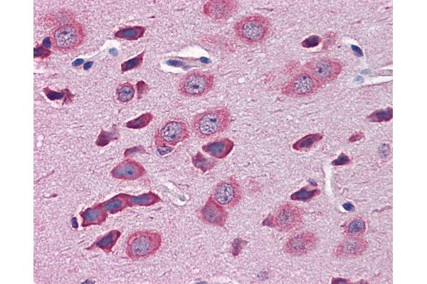 TBR1 antibody  (AA 51-100)
