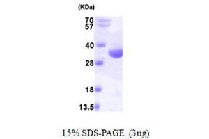 SDS-PAGE (SDS) image for RCD1 Required For Cell Differentiation1 Homolog (RQCD1) (AA 1-299) protein (His tag) (ABIN667268) (RQCD1 Protein (AA 1-299) (His tag))