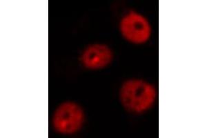 ABIN6269101 staining MOLT by IF/ICC. (Retinoblastoma 1 antibody  (C-Term))