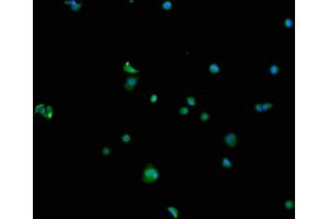Immunofluorescence staining of MCF-7 cells with ABIN7168807 at 1:100, counter-stained with DAPI. (SEMA4F antibody  (AA 417-659))