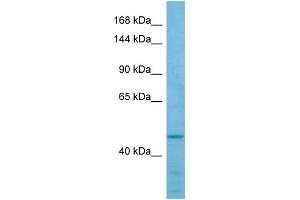 Western Blotting (WB) image for anti-Formin-Like 2 (FMNL2) (Middle Region) antibody (ABIN2790212) (FMNL2 antibody  (Middle Region))