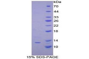 SDS-PAGE analysis of Dog IP10 Protein. (CXCL10 Protein)