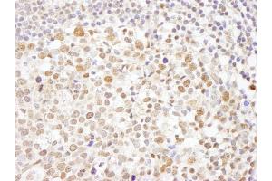 anti-Chromatin Assembly Factor 1, Subunit A (p150) (CHAF1A) (AA 100-150) antibody