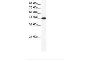 Image no. 1 for anti-Amiloride-Sensitive Cation Channel 5, Intestinal (ACCN5) (AA 201-250) antibody (ABIN202676)
