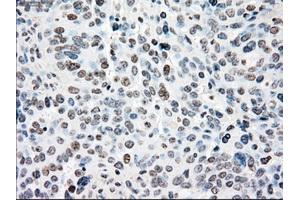 Immunohistochemical staining of paraffin-embedded colon tissue using anti-NRBP1mouse monoclonal antibody. (NRBP1 antibody)
