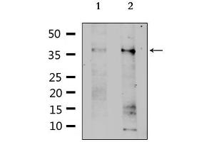 SLC39A1 antibody  (Internal Region)