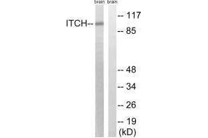 Western blot analysis of extracts from mouse brain cells, using ITCH (Ab-420) antibody. (ITCH antibody  (Tyr420))