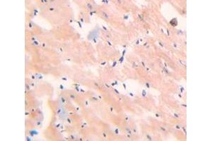 IHC-P analysis of Kidney tissue, with DAB staining. (Myoglobin antibody  (AA 1-154))