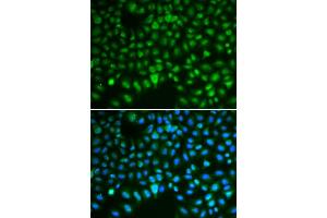 Immunofluorescence analysis of HeLa cells using DLG antibody (ABIN6130274, ABIN6139656, ABIN6139657 and ABIN6217626). (DLGAP5 antibody  (AA 547-846))
