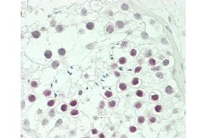 Formalin-fixed and paraffin-embedded H. (CBX8 antibody  (AA 197-230))