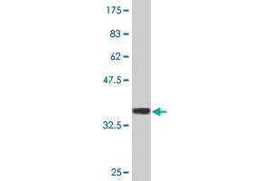 Western Blot detection against Immunogen (37. (FN3K antibody  (AA 61-170))