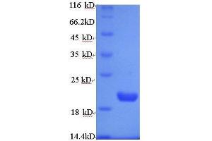 SDS-PAGE (SDS) image for Vascular Endothelial Growth Factor A (VEGFA) (AA 27-190) protein (His tag) (ABIN1472517)