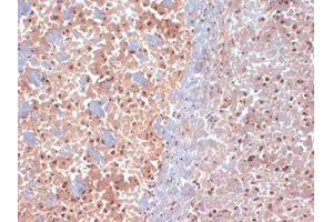 SAP97 Immunohistochemistry. (DLG1 antibody  (N-Term))