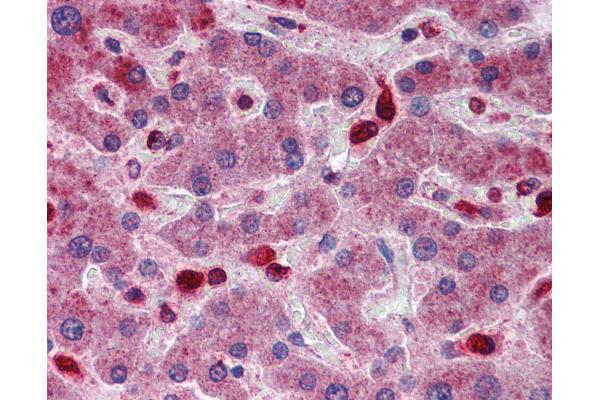 ACP2 antibody  (AA 144-193)