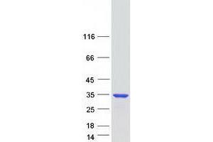 Western Blotting (WB) image for Zinc Finger, C4H2 Domain Containing (ZC4H2) protein (Myc-DYKDDDDK Tag) (ABIN2735801)