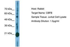 Image no. 1 for anti-Core-Binding Factor, beta Subunit (CBFB) (N-Term) antibody (ABIN6749810) (CBFB antibody  (N-Term))
